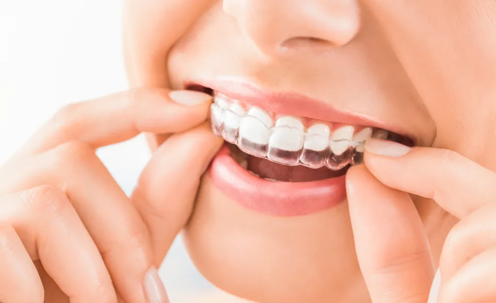 woman putting on Invisalign aligner at Brantford Dental Care